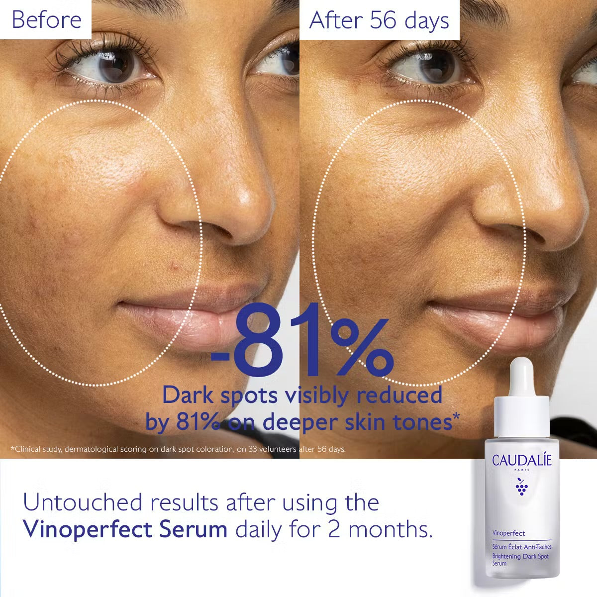 Caudalie Vinoperfect Brightening Dark Spot Serum